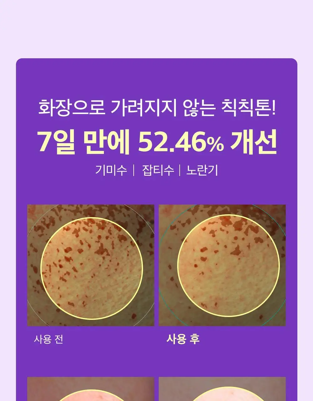 [잡티미백케어] 성분에디터 머루포도 비타씨 다크 스팟 앰플 40ml 더블기획 상세페이지 6